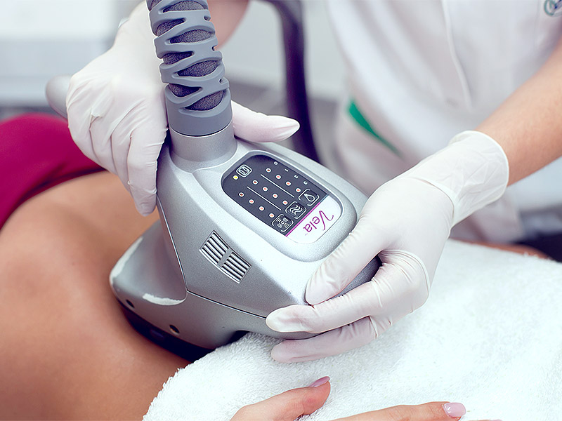 featured tratament velashape estetpro