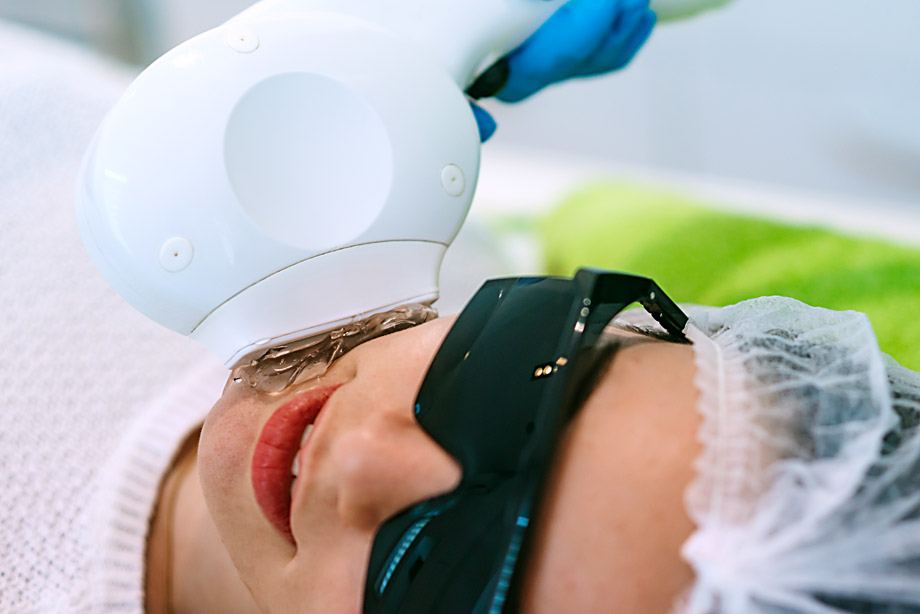 tratament-foto-SPL-OR-LIGHT-estet-pro